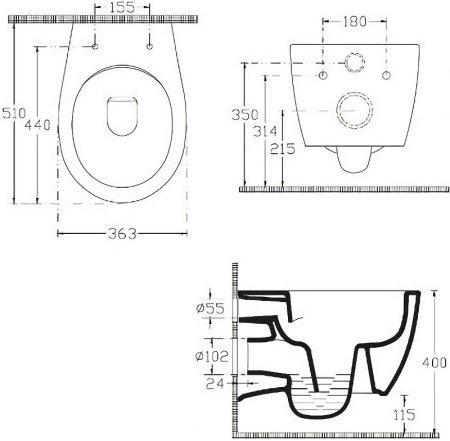 Унитаз биде Allen Brau Fantasy 4.11HC1.20 подвесной Белый без сиденья 
