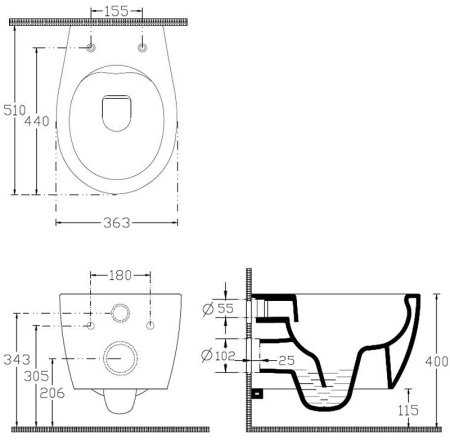 Унитаз Allen Brau Fantasy 4.11004.IV подвесной Айвори без сиденья 